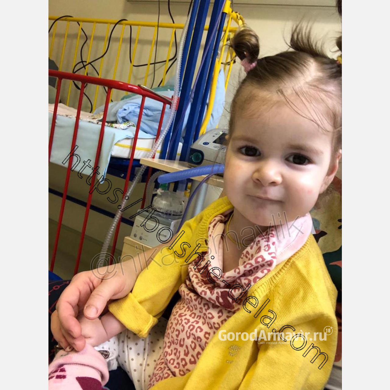 Тяжелобольной 2-летней девочке требуется собрать на лечение 180 миллионов рублей 