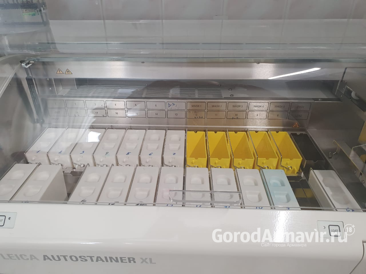На Кубани выявлено 235 суточных больных коронавирусом 
