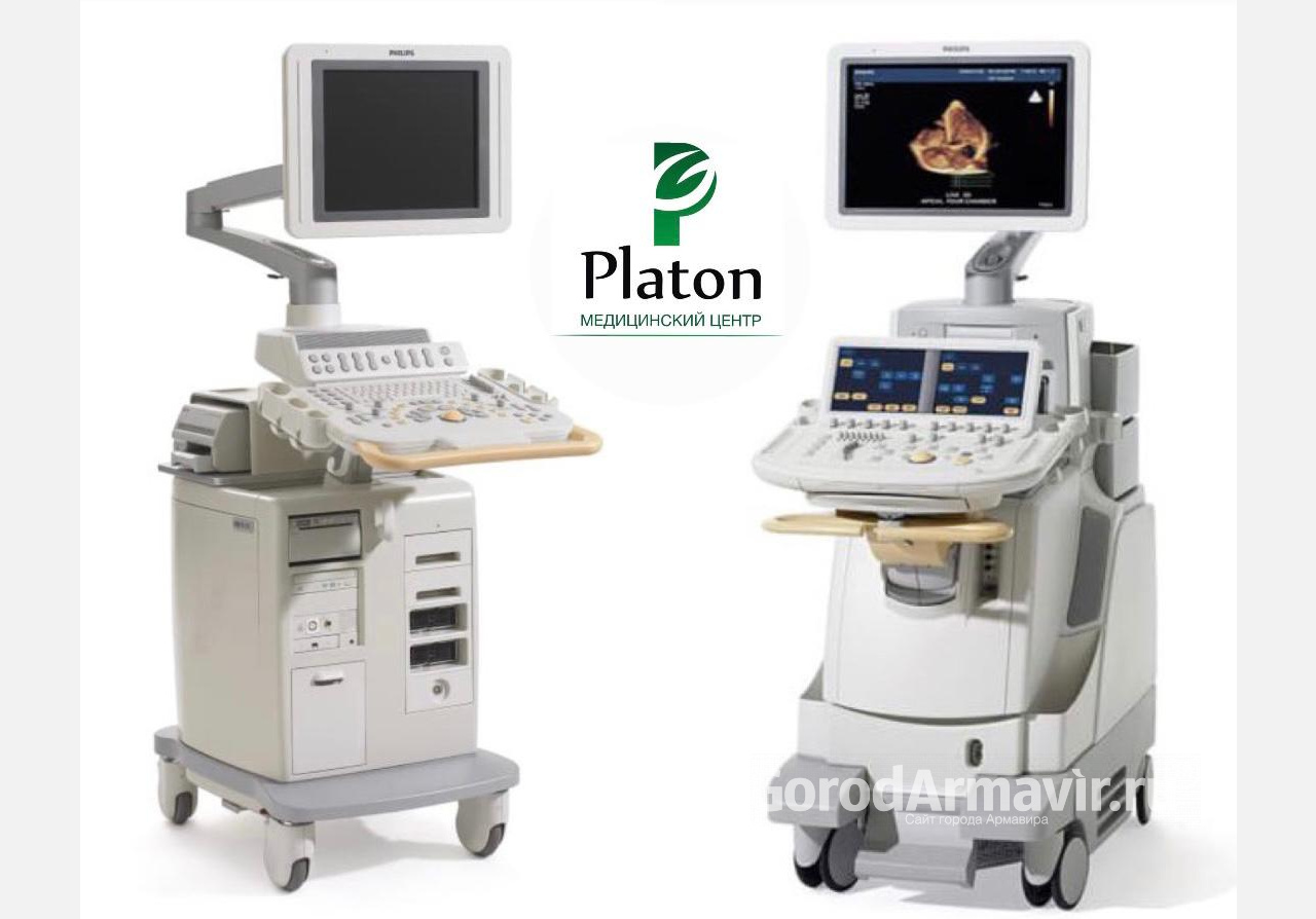 В медицинском центре «Платон» появились два новых УЗИ сканера экспертного уровня