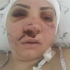 Полиция Армавира продолжает розыск избившего семейную пару молотком Надара Дохояна